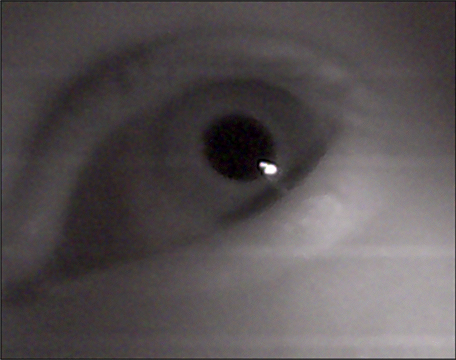 Showing the reflection of IR light in the eye where the LED is placed at the same distance from the eye surface as the distance to the lens of the camera.
